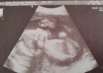 Aborto sì. Aborto no