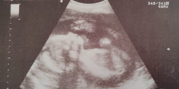 Aborto sì. Aborto no