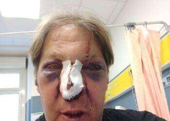 Cagliari, il giornalista Antonello Lai pubblica una foto scioccante: circondato e pestato a sangue