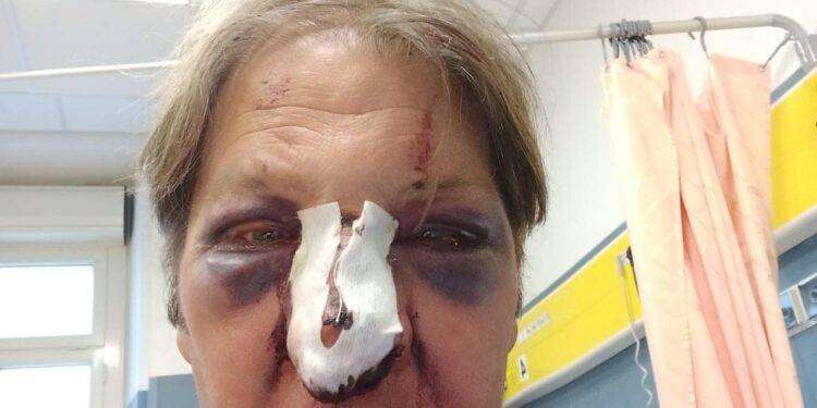 Cagliari, il giornalista Antonello Lai pubblica una foto scioccante: circondato e pestato a sangue