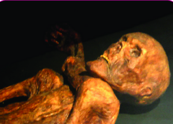 Oetzi aveva la pella scura e soffriva di calvizie