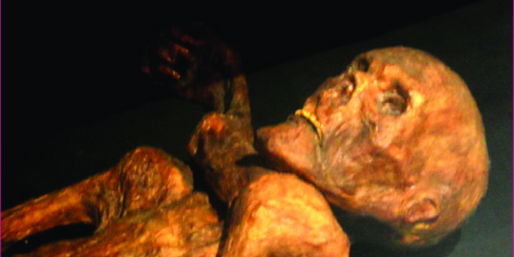 Oetzi aveva la pella scura e soffriva di calvizie