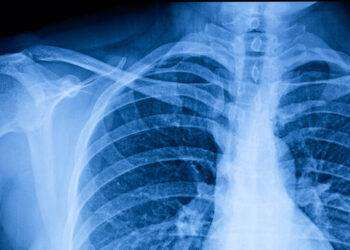 Non solo rughe, la vera età è scritta anche nel torace