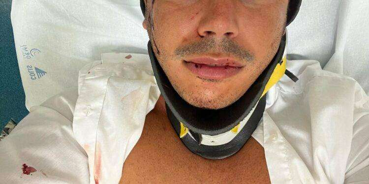 Poetto, pestato a sangue per un orologio: aggredito influencer 30 enne