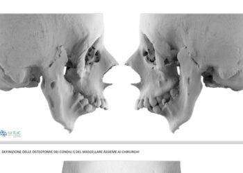 Nata con la bocca serrata, ora a 16 anni sorride