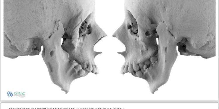Nata con la bocca serrata, ora a 16 anni sorride