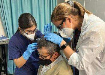 Torna l’Alopecia day, visite gratuite al San Giovanni di Dio