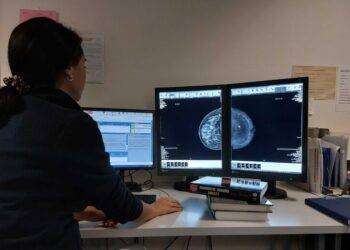 Cagliari, mammografo con mezzo di contrasto per diagnosi precoci