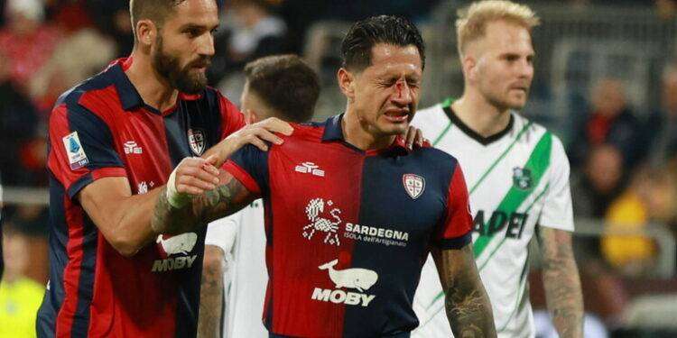 Calcio: Cagliari, Lapadula operato dopo rottura setto nasale