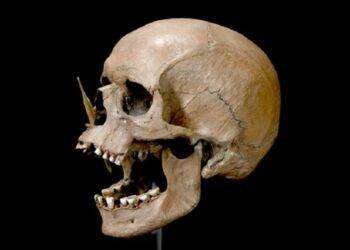 Nel Dna antico le radici di Alzheimer e sclerosi multipla