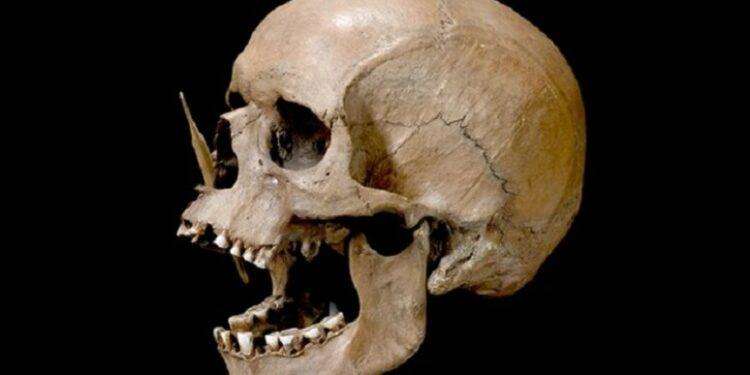 Nel Dna antico le radici di Alzheimer e sclerosi multipla