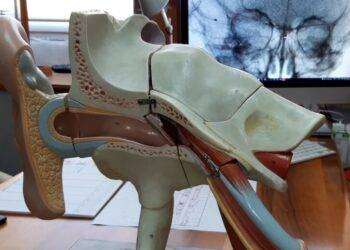 Screening sulla sordità, appuntamento il 4 marzo a Sassari