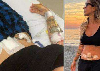 L’artista Deborah De Luca ha avuto il tumore: “Non avevo sintomi, sono stata operata d’urgenza”