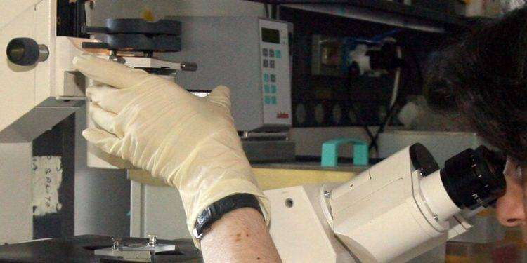 Si aprono nuove prospettive per il trattamento della Sla