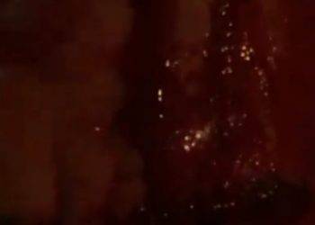 Chef Rubio con il volto tumefatto pubblica un video: “Mi hanno massacrato”