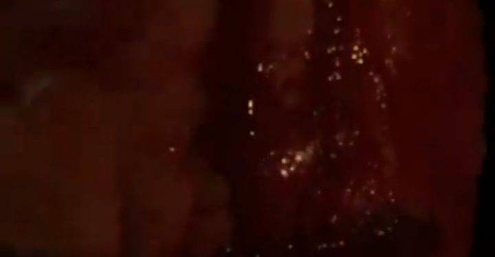 Chef Rubio con il volto tumefatto pubblica un video: “Mi hanno massacrato”