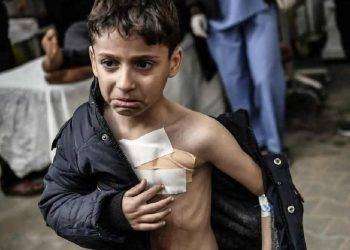 La malnutrizione a Gaza è aumentata del 300% a luglio