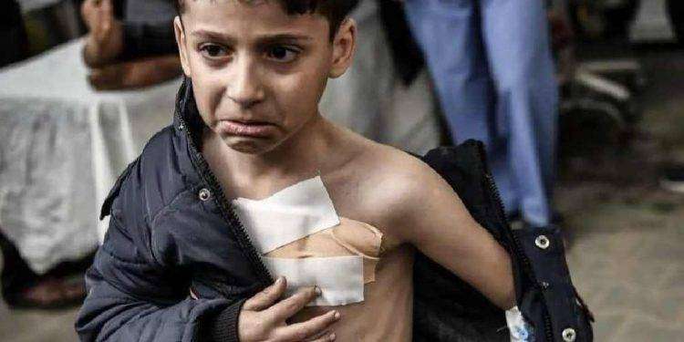 La malnutrizione a Gaza è aumentata del 300% a luglio