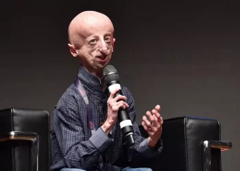 E’ morto Sammy Basso, ha fatto conoscere la progeria