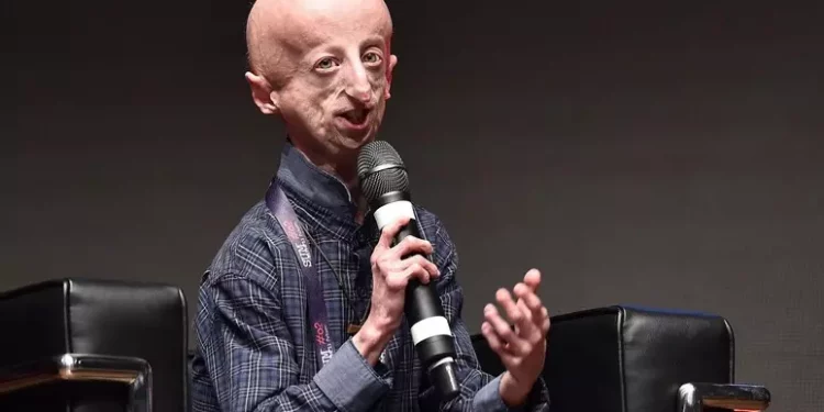 E’ morto Sammy Basso, ha fatto conoscere la progeria