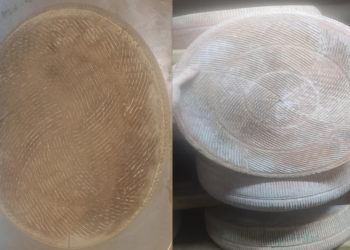 Caso di escherichia coli in una bambina, ministero della salute segnala ritiro formaggio trentino. Allerta per rischio microbiologico