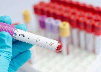 La Fials denuncia: “Al Santissima Trinità mancano i reagenti, nessun test a pazienti con Hiv ed Epatiti”