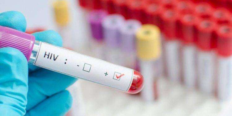 La Fials denuncia: “Al Santissima Trinità mancano i reagenti, nessun test a pazienti con Hiv ed Epatiti”