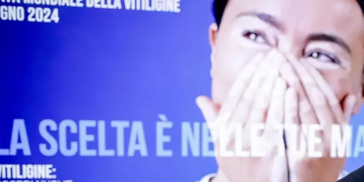 Un open day a Sassari dedicato alla vitiligine