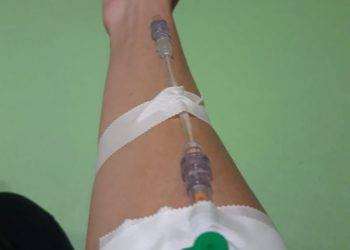 Anche in Sardegna sciopero della fame per legge su fibromialgia