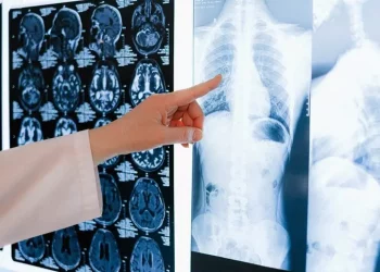 La multidisciplinarietà contro i tumori toraco-polmonari