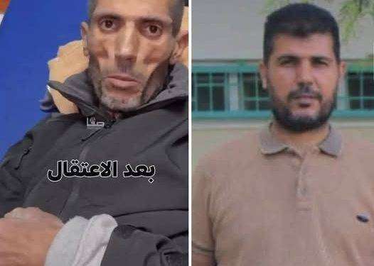 Prima e dopo la detenzione nel carcere del regime israeliano: questo è genocidio