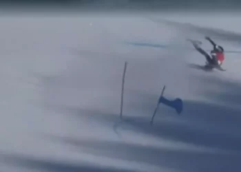 Brignone, frattura del piatto tibiale e testa del perone sinistro