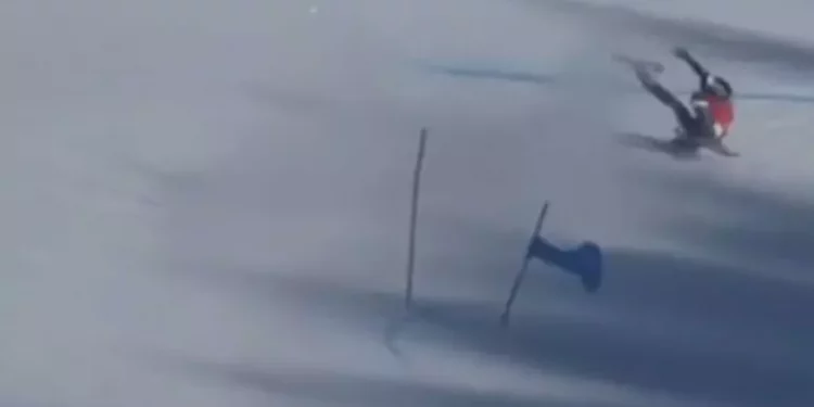 Brignone, frattura del piatto tibiale e testa del perone sinistro